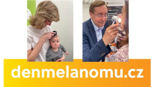 Den melanomu